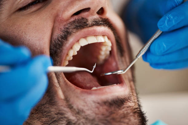 Best Emergency Dental Services for Seniors in Yaphank, NY